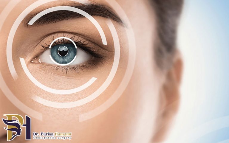 تقویت چشم ها بعد از جراحی لیزیک
