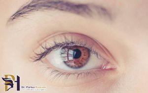 مقایسه عمل لازک و لیزیک
