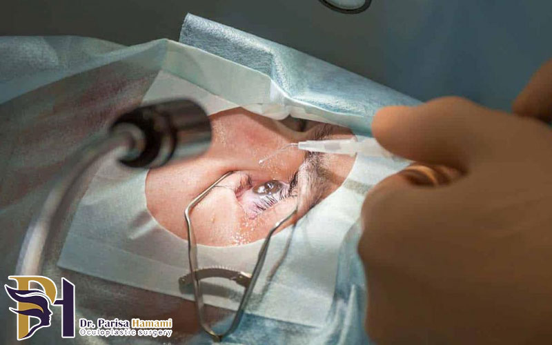 فمتولیزیک چیست