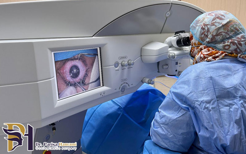 فمتولیزیک چیست