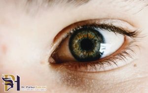 شایع ترین بیماری های چشمی