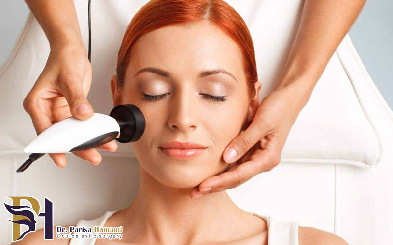 جوانسازی صورت با آر اف RF