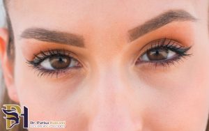 چه کسانی به جراحی پلاستیک چشم نیاز دارند