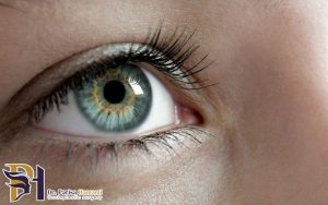 علائم تومور حدقه چشم چیست