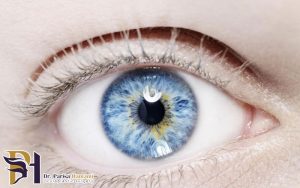 بیماری های ارثی و ژنتیکی چشم