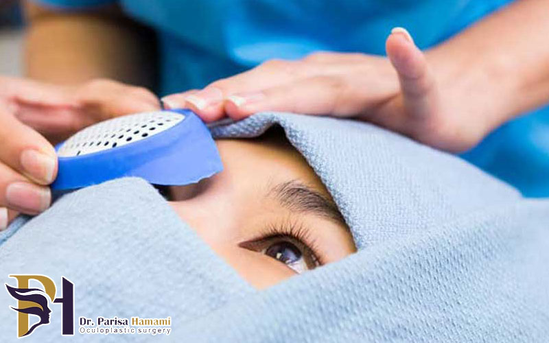 حذف عینک با فمتولیزیک