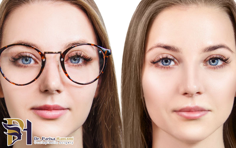 آیا چشم بعد از عمل لیزیک ضعیف می شود