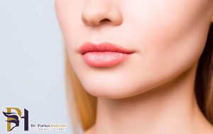 زاویه سازی صورت با ژل