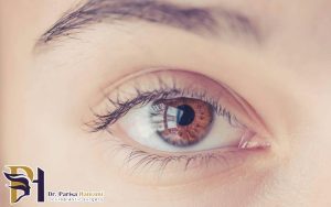 حداقل و حداکثر نمره چشم برای عمل لیزیک