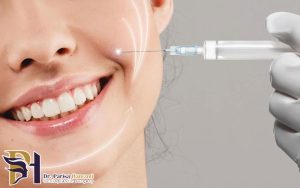 بوتاکس خط خنده