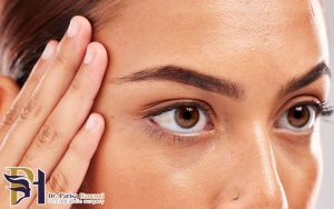 بوتاکس جایگزین جراحی لیفت ابرو
