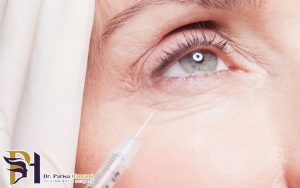 پیشگیری از عوارض تزریق بوتاکس در ناحیه اطراف چشم