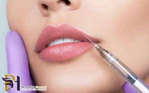 بهترین انتخاب برای فرم دهی به لب ها