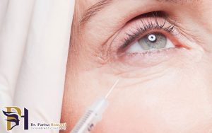 بهترین مناطق صورت برای تزریق بوتاکس
