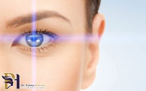 آیا سوزش چشم بعد از عمل فمتو لیزیک طبیعی است