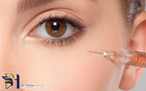 بوتاکس و تاثیر آن بر رفع چین و چروک دور چشم