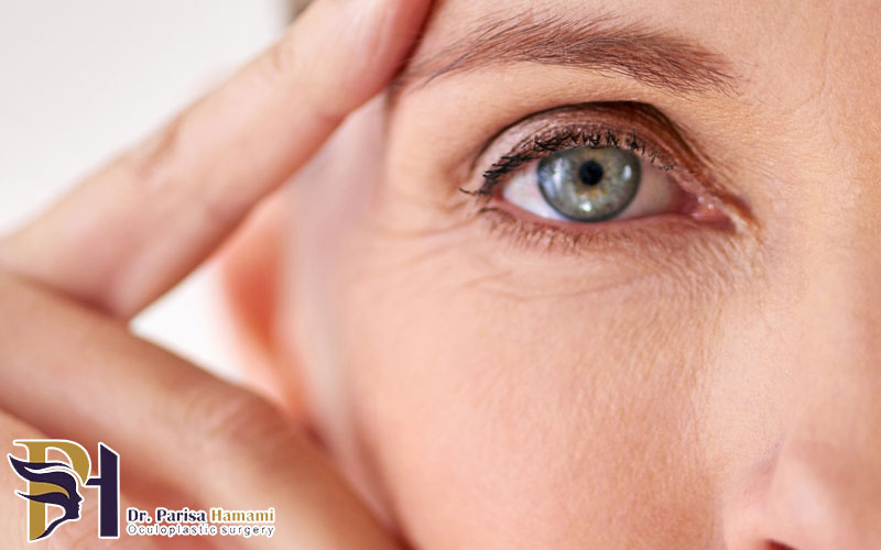 همه چیز درباره اکولوپلاستی