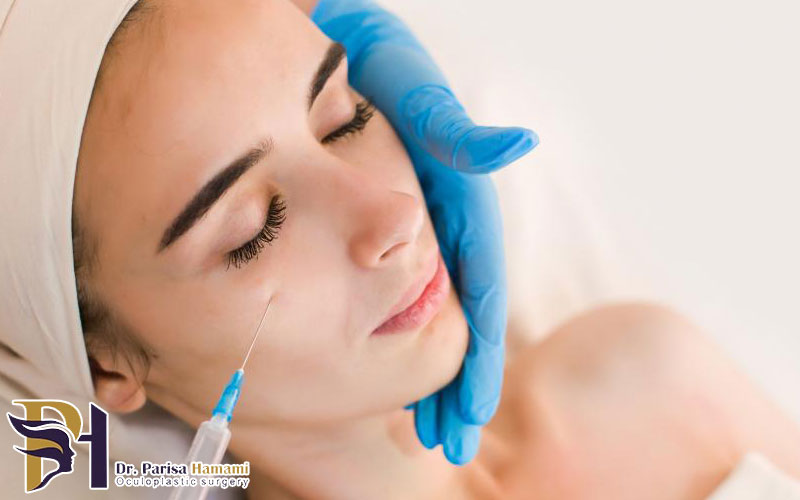 بوتاکس دور چشم در سنین پایین