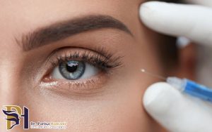 بوتاکس دور چشم در سنین پایین