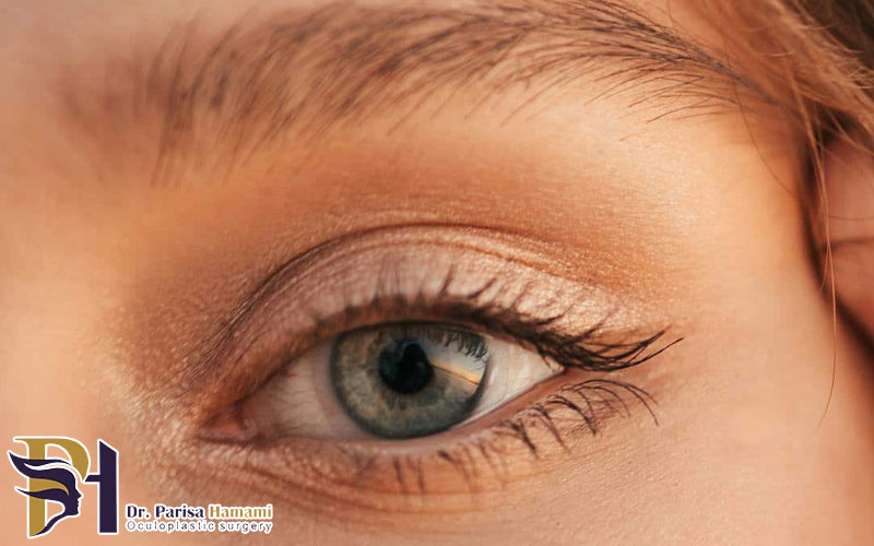 بهترین روش ‌های غیر جراحی برای لیفت ابرو