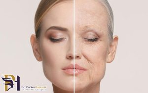 بوتاکس در افراد مسن بالای ۶۰ سال