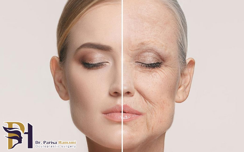بوتاکس در افراد مسن بالای ۶۰ سال