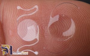 عمل کاشت لنز داخل چشمی