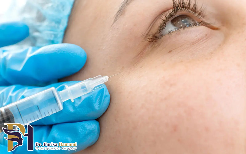 تزریق مزوژل زیر چشم چیست