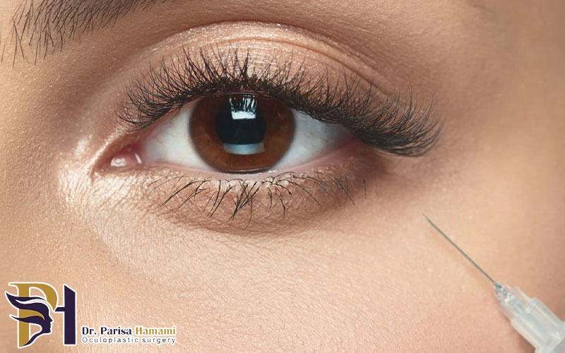 تزریق مزوژل زیر چشم چیست
