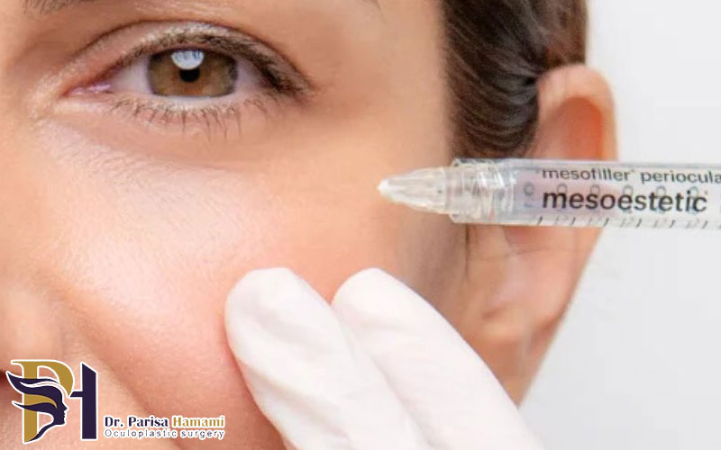 تزریق مزوژل زیر چشم چیست